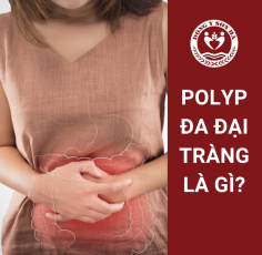 Đa polyp đại tràng là gì? Những điều cần biết về hội chứng đa polyp tuyến gia đình 